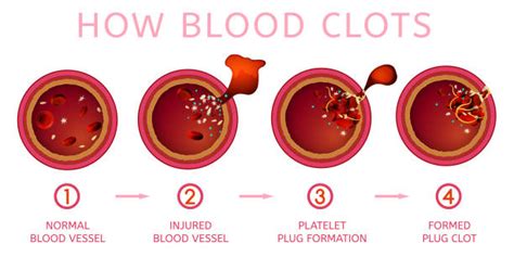 what does the word clotting mean
